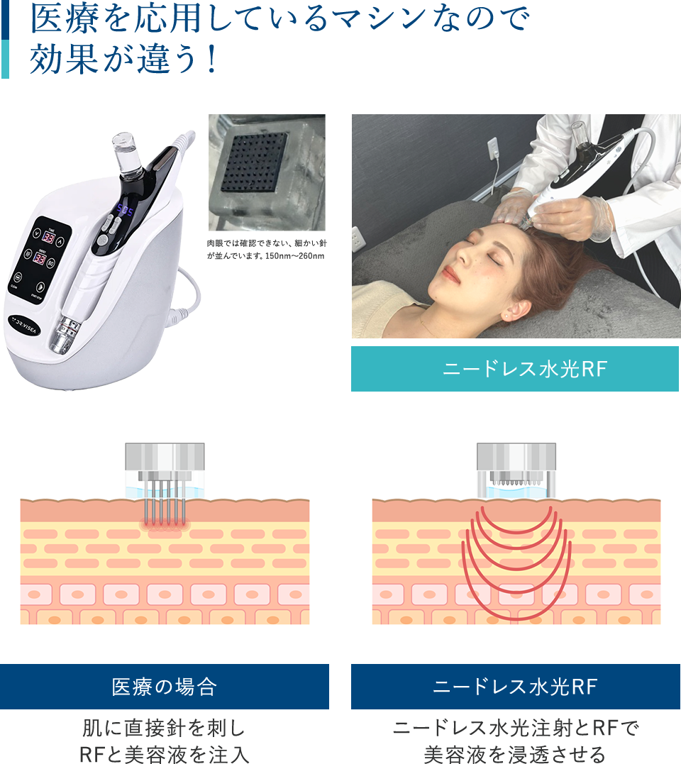医療を応用しているマシンなので効果が違う！ニードレス′F